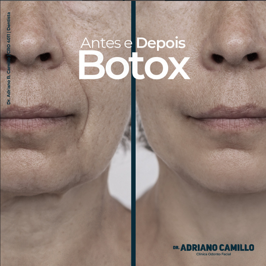 DTM e Dor Orofacial - Galeria 1